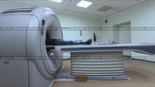 ESSENTUKI - FEBRUARY 1: Computed tomography of the lungs of a patient diagnosed with Covid-19. February 1, 2022 in Essentuki, Russia. Редакционное видео, видеограф Сергей Сергеев / Фотобанк Лори