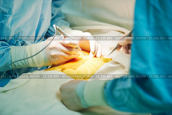 hands of cardiac surgeon at surgery operation. Стоковое фото, фотограф Дмитрий Калиновский / Фотобанк Лори
