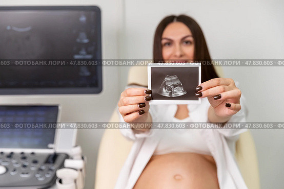Happy young pregnant woman holding and showing ultrasound scan photo. Smiling mother with sonogram of her unborn baby. Concept of pregnancy. Maternity prenatal care. Стоковое фото, фотограф Ирина Михайличенко / Фотобанк Лори