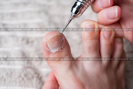 Hardware pedicure for yourself, ingrown toenail, chiropody and podology concept, foot care. Стоковое фото, фотограф Станислав Тарко / Фотобанк Лори