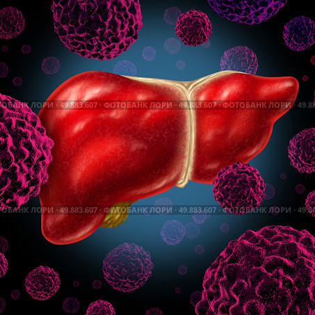Human liver cancer organ as a medical symbol of a malignant tumor red cell disease as a cancerous growth spreading through the digestive system by alcohol and other environmental toxic reasons. Стоковое фото, агентство Ingram Publishing / Фотобанк Лори