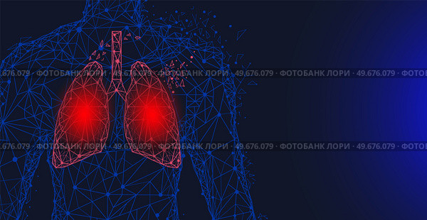 Human lungs surgery operation low poly. Medicine, disease, drug treatment, painful area. Polygonal human lungs with area of pain. Organ of human respiratory system. Bronchitis, pneumonia diagnostics. Polygonal lungs with painful area. Human respiratory system organ. Bronchitis, pneumonia diagnostics. Стоковая иллюстрация, агентство Ingram Publishing / Фотобанк Лори
