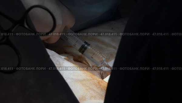 Inserting a needle under the skin of the patient body. Стоковое фото, фотограф David Kashakhi / Фотобанк Лори