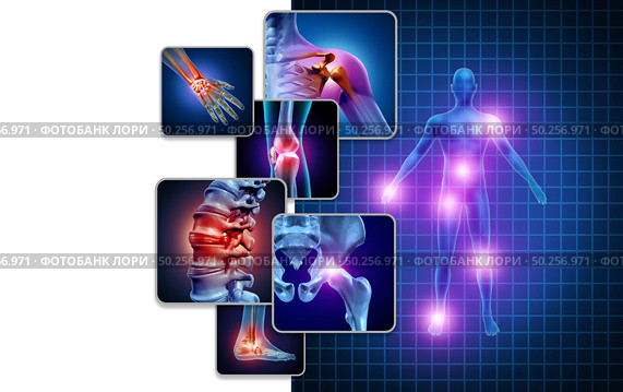 Joint body pain concept as skeleton and muscle anatomy of the body with a group of sore joints as a painful injury or arthritis illness symbol for health care and medical symptoms with 3D illustration elements. Стоковое фото, агентство Ingram Publishing / Фотобанк Лори