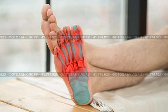 Joint diseases, hallux valgus, plantar fasciitis, man's leg hurts, pain in the foot. Стоковое фото, фотограф Станислав Тарко / Фотобанк Лори
