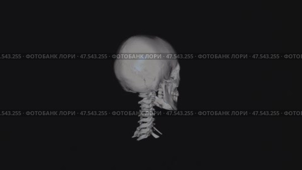 Компьютерная томография головы и шеи человека (КТ). 3D реконструкция черепа и шейного отдела позвоночника. Computed tomography of the human head and neck (CT). 3D reconstruction of the skull and cervical spine. Стоковое видео, видеограф Горшков Александр / Фотобанк Лори