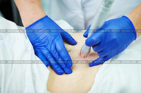 Laser cosmetic surgery and skin resurfacing in dermatology. Стоковое фото, фотограф Дмитрий Калиновский / Фотобанк Лори