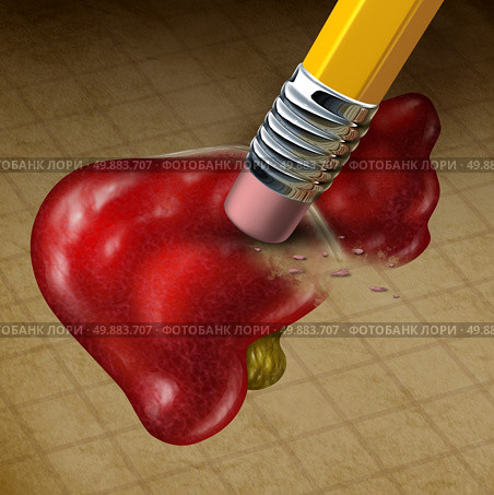 Losing liver function health and a decline in digestion and detoxification system caused by cancer or disease as a pencil eraser erasing an old grunge medical illustration of the human gland on parchment paper. Стоковое фото, агентство Ingram Publishing / Фотобанк Лори