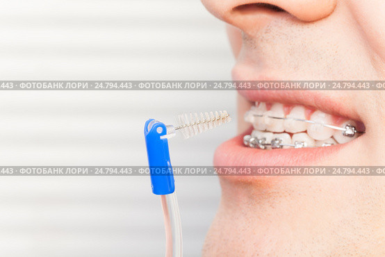 Man using interdental brush for orthodontic braces. Стоковое фото, фотограф Сергей Новиков / Фотобанк Лори