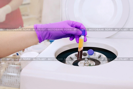 Medical vial with blood plasma in hand for PRP extracted from the centrifuge machine. Стоковое фото, фотограф Ольга Зиновская / Фотобанк Лори
