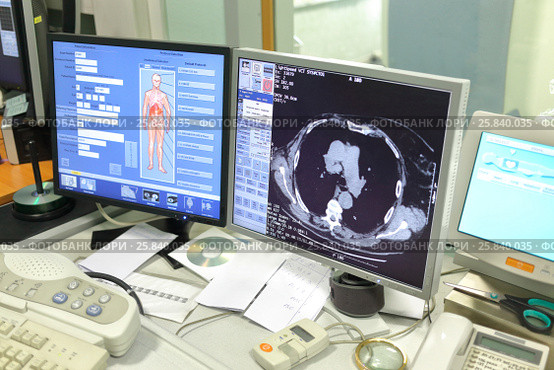 MOSCOW - AUG 31, 2015: Monitor screen in radiology X-ray examination in multidisciplinary clinic CELT. Редакционное фото, фотограф Losevsky Pavel / Фотобанк Лори