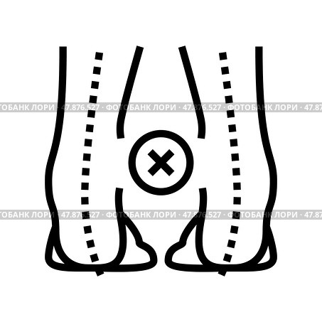 outward curvature of legs line icon vector illustration. Стоковая иллюстрация, иллюстратор Vectorwin / Фотобанк Лори