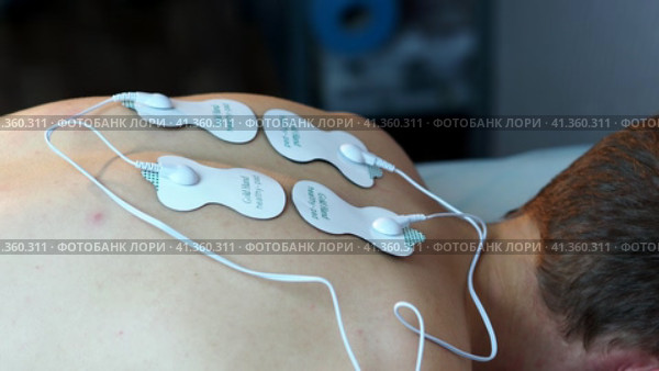 Physiotherapy. Electrotherapy and myostimulation of the back muscles. Physiotherapy treatment for rehabilitation.  Физиотерапия. Электротерапия и миостимуляция мышц спины. Физиотерапевтическое лечение для реабилитации. Стоковое видео, видеограф Egor Sarantstv / Фотобанк Лори