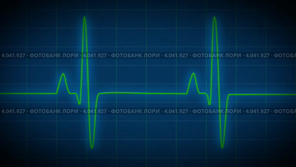 Сердцебиение на мониторе. Стоковая анимация, аниматор Александр Дейнега / Фотобанк Лори
