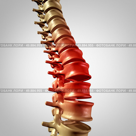 Spine pain and lower back disease and human backache with a three dimensional spinal body skeleton showing the vertebra and vertebral column in glowing red highlight as a medical health care concept for joint pain. Стоковое фото, агентство Ingram Publishing / Фотобанк Лори