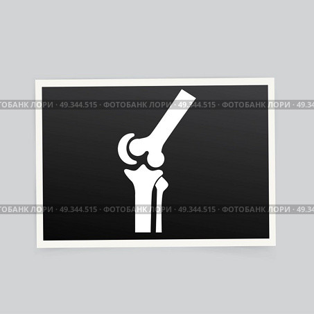 X-ray of the knee. Vector illustration. Стоковая иллюстрация, агентство Ingram Publishing / Фотобанк Лори